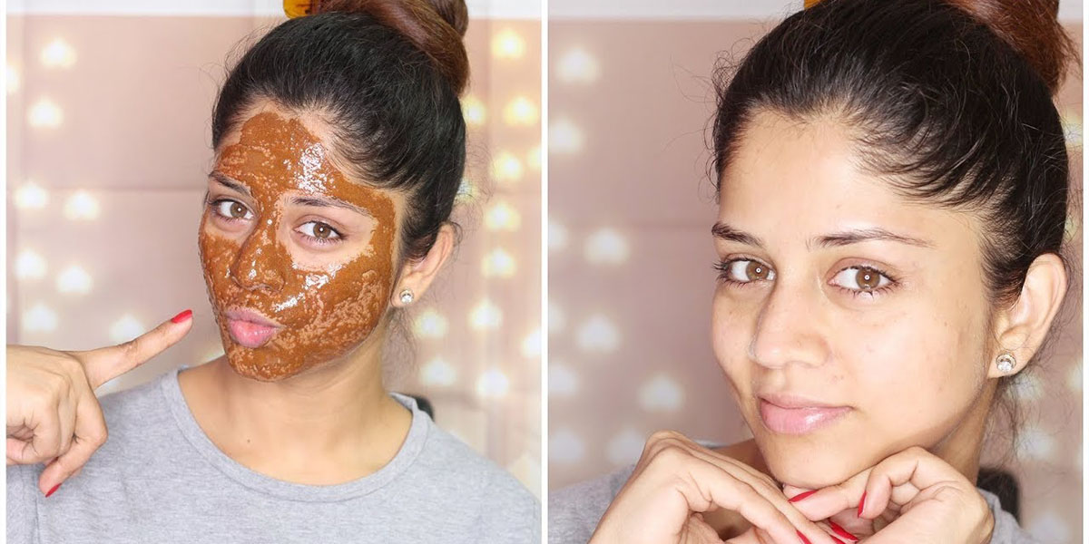 Get rid of acne fast 12 home remedies KENYAN MOVES