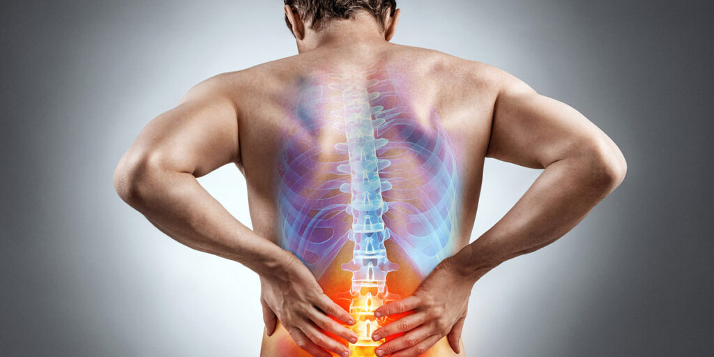 Causes of lower back pain