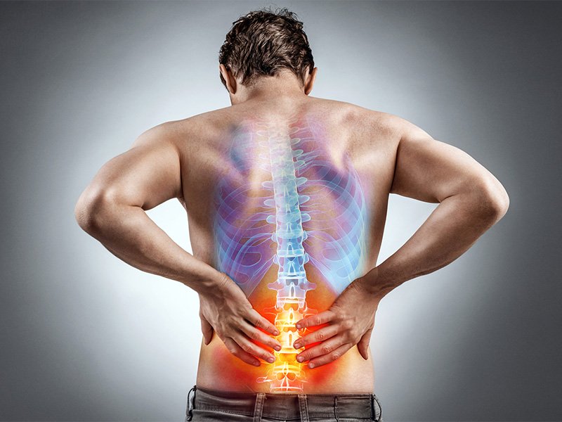 Read more about the article Top 10 causes of lower back pain you should know